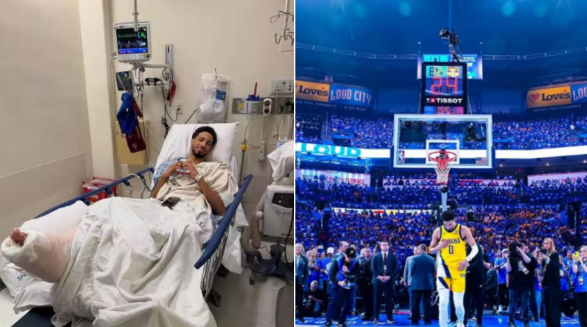 預計新賽季接著報銷！哈里伯頓更新社媒：我想念籃球了！